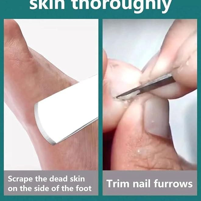 5 Pieces Pedicure Knife Set with Storage Case - Ankaa Store