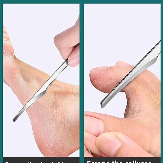 5 Pieces Pedicure Knife Set with Storage Case - Ankaa Store