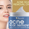 Kurai™ Scar Removal Cream Gel – Advanced Acne Spot, Stretch Mark & Burn Repair Treatment